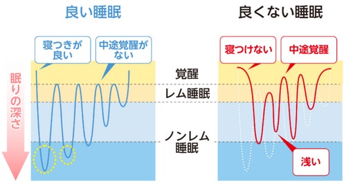 睡眠ダイエットって?良い睡眠をとるポイント!