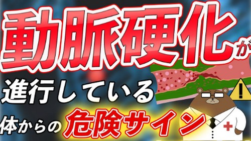 動脈硬化って?原因や進行を防ぐポイント!