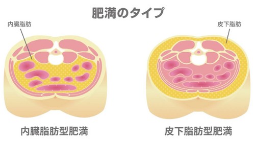メタボリックシンドロームって？健康への悪影響！
