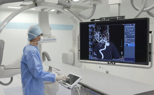 動脈硬化って?原因や進行を防ぐポイント!