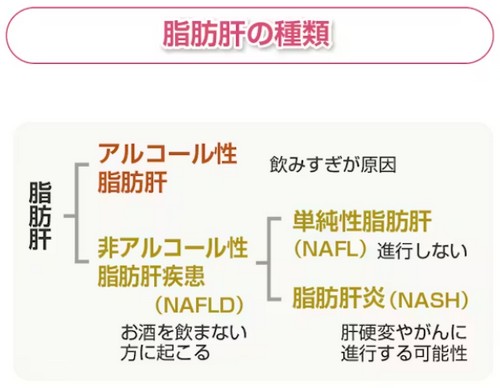 脂肪肝は大きな病気を引き起こす?改善法は!
