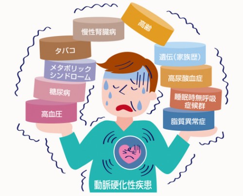 動脈硬化って?原因や進行を防ぐポイント!