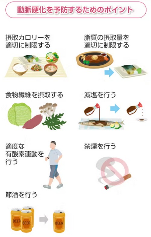 動脈硬化って?原因や進行を防ぐポイント!