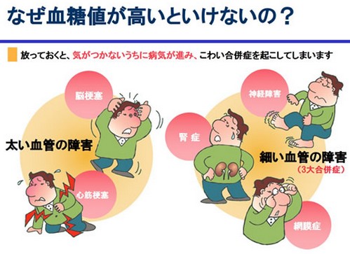 動脈硬化って?原因や進行を防ぐポイント!